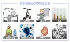 前列腺钙化有哪些症状